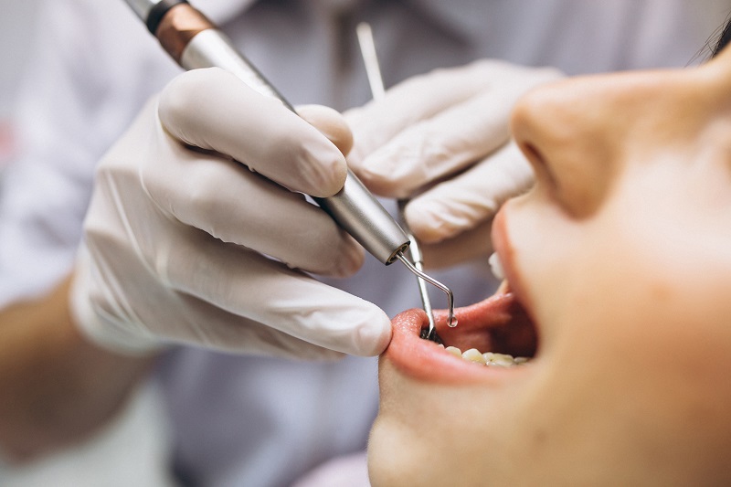Gabinety stomatologiczne Warszawa – miejsca ratunku dla twoich zębów